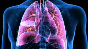 digital x-ray image of the lungs